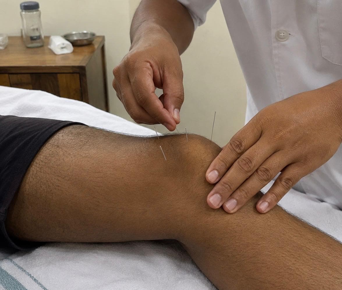 Acupuncture points being placed along a patient's back.