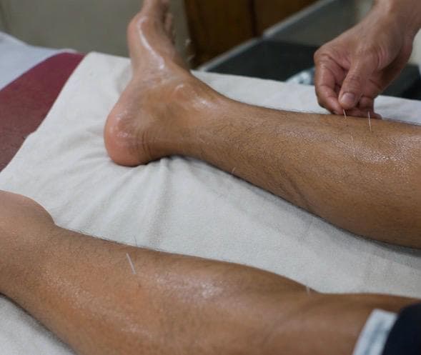 Patient resting quietly while needles are retained.