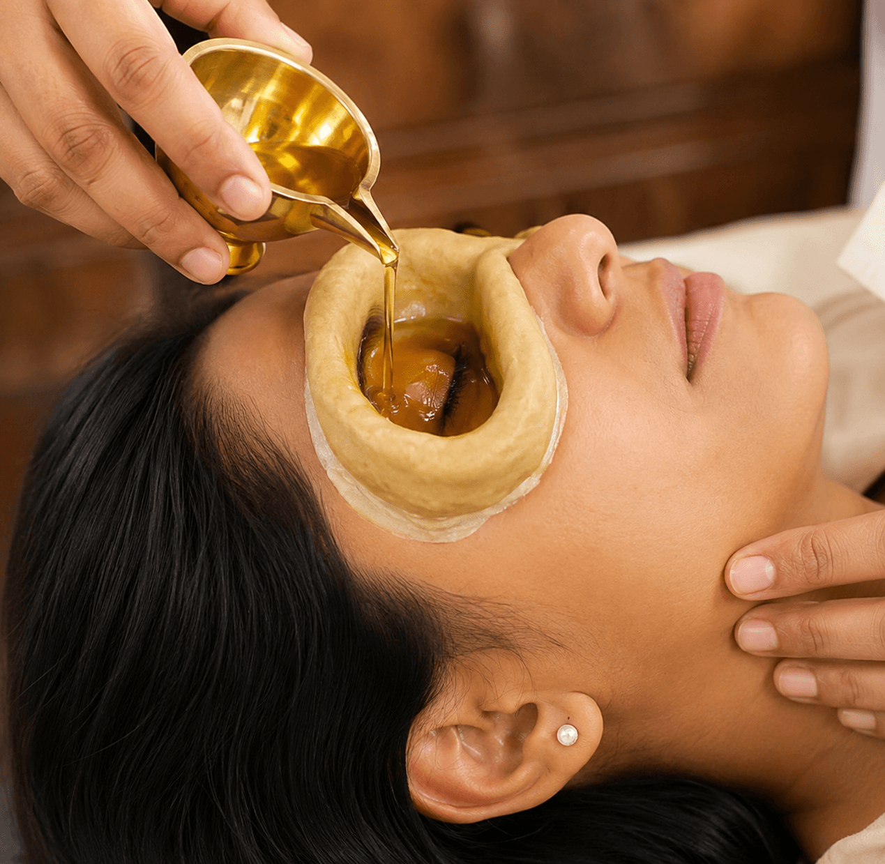 Eye well filled with warm ghee, the eyelashes immersed while the patient blinks gently.